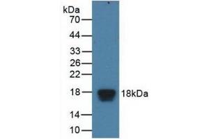 Western Blotting (WB) image for anti-Eukaryotic Translation Initiation Factor 4E Binding Protein 1 (EIF4EBP1) (AA 2-118) antibody (ABIN7436819)