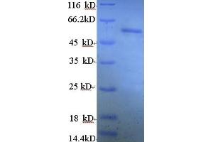 SDS-PAGE (SDS) image for Estrogen Receptor 2 (ESR2) (AA 2-530) protein (His tag) (ABIN5713440) (ESR2 Protein (AA 2-530) (His tag))