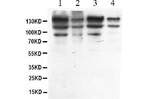 Western blot analysis of ADAR1 expression in HELA whole cell lysates ( Lane 1), A549 whole cell lysates ( Lane 2), MCF-7 whole cell lysates ( Lane 3) and HEPG2 whole cell lysates ( Lane 4). (ADAR 抗体  (AA 128-346))