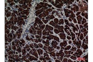 Immunohistochemistry (IHC) analysis of paraffin-embedded Human Pancreas, antibody was diluted at 1:100. (CD1e 抗体  (C-Term))