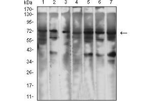 Western Blotting (WB) image for anti-Glypican 3 (GPC3) (AA 359-554) antibody (ABIN7193542)