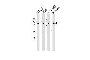 Western blot analysis of lysates from HT-29, PC-3, U-87 MG cell line and human testis tissue lysate(from left to right), using OASL Antibody  (ABIN390168 and ABIN2840664). (OASL 抗体  (C-Term))