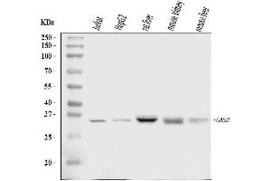 Western blot analysis of GAS2 using anti-GAS2 antibody (ABIN7603220).