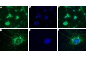 Immunocytochemistry (ICC) image for anti-Calcium Channel, Voltage-Dependent, T Type, alpha 1H Subunit (CACNA1H) (AA 581-595), (Intracellular) antibody (ABIN7043010)