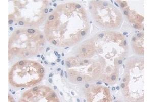 Detection of TPP1 in Human Kidney Tissue using Polyclonal Antibody to Tripeptidyl Peptidase I (TPP1) (TPP1 抗体  (AA 1-320))