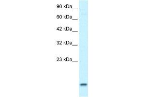 WB Suggested Anti-UBE2N Antibody Titration:  1. (UBE2N 抗体  (Middle Region))