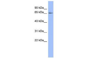 WB Suggested Anti-ZNF329 Antibody Titration:  0. (ZNF329 抗体  (Middle Region))
