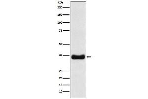 Western blot analysis of Olig1 expression in MOLT4 cell lysate.