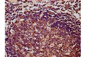 IHC image of ABIN7166787 diluted at 1:400 and staining in paraffin-embedded human lymph node tissue performed on a Leica BondTM system. (IBA57 抗体  (AA 286-356))