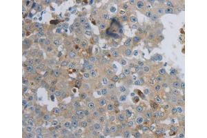 Immunohistochemistry (IHC) image for anti-Creatine Kinase, Mitochondrial 1A (CKMT1A) antibody (ABIN5546002) (CKMT1A 抗体)