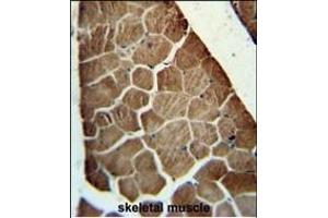 ADSSL1 antibody (N-term) (ABIN652054 and ABIN2840523) immunohistochemistry analysis in formalin fixed and paraffin embedded human skeletal muscle followed by peroxidase conjugation of the secondary antibody and DAB staining. (ADSSL1 抗体  (N-Term))