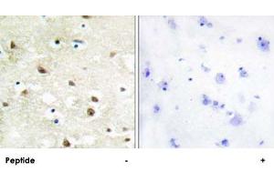 Immunohistochemistry analysis of paraffin-embedded human brain tissue using HNRNPC polyclonal antibody . (HNRNPC 抗体)