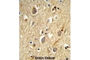 Immunohistochemistry (IHC) image for anti-RAB8A, Member RAS Oncogene Family (RAB8A) antibody (ABIN3003984) (RAB8A 抗体)