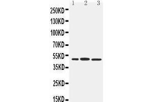 Anti-IRF8 antibody, Western blotting Lane 1: RAJI Cell Lysate Lane 2: Rat Liver Tissue Lysate Lane 3: Rat Kidney Tissue Lysate (IRF8 抗体  (C-Term))