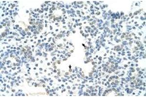 Immunohistochemical staining (Formalin-fixed paraffin-embedded sections) of human lung with HOXC10 polyclonal antibody  at 4-8 ug/mL working concentration. (HOXC10 抗体  (N-Term))