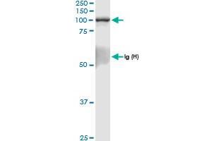 Immunoprecipitation of RAPGEF3 transfected lysate using anti-RAPGEF3 MaxPab rabbit polyclonal antibody and Protein A Magnetic Bead , and immunoblotted with RAPGEF3 MaxPab rabbit polyclonal antibody (D01) . (RAPGEF3 抗体  (AA 1-881))
