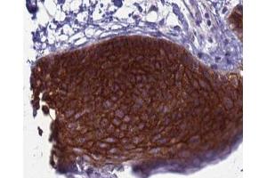 ABIN6266974 at 1/100 staining human skin tissue sections by IHC-P. (Retinol Binding Protein 5 抗体  (Internal Region))