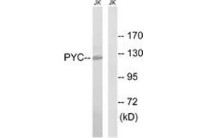 Western blot analysis of extracts from Jurkat cells, using PC Antibody. (PC (AA 357-406) 抗体)