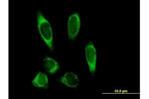 Immunofluorescence of purified MaxPab antibody to PLOD2 on HeLa cell. (PLOD2 抗体  (AA 1-758))