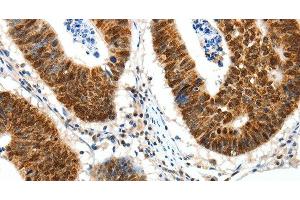 Immunohistochemistry (Paraffin-embedded Sections) (IHC (p)) image for anti-Sp1 Transcription Factor (SP1) antibody (ABIN7242698)