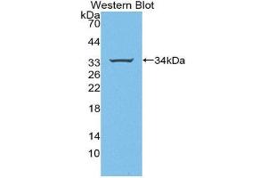 Western Blotting (WB) image for anti-Signal Transducing Adaptor Molecule (SH3 Domain and ITAM Motif) 1 (STAM) (AA 196-465) antibody (ABIN2117564) (STAM 抗体  (AA 196-465))