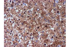 Immunohistochemical staining of paraffin-embedded Human liver tissue using anti-NNMT mouse monoclonal antibody. (NNMT 抗体)