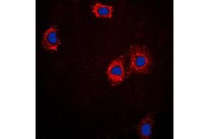Immunofluorescent analysis of cTnI staining in A431 cells. (TNNI3 抗体  (Center))