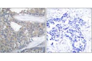 Immunohistochemistry (IHC) image for anti-Paxillin (PXN) (AA 15-64) antibody (ABIN2889052) (Paxillin 抗体  (AA 15-64))