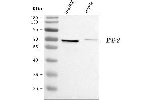 Western blot analysis of MMP2 using anti-MMP2 antibody (ABIN7601678).