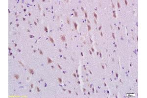 Formalin-fixed and paraffin embedded rat brain labeled with Rabbit Anti-PDGFBB Polyclonal Antibody, Unconjugated  at 1:200 followed by conjugation to the secondary antibody and DAB staining (PDGF-BB Homodimer (AA 151-241) 抗体)