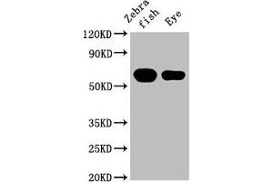 Western Blot Positive WB detected in: Zebrafish tissue, Zebrafish eye tissue All lanes: cyp26a1 at 1:2000 Secondary Goat polyclonal to rabbit IgG at 1/50000 dilution Predicted band size: 57 kDa Observed band size: 57 kDa (CYP26A1 抗体  (AA 244-371))