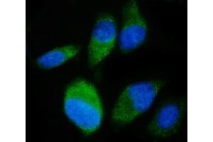 IF analysis of SND1 using anti-SND1 antibody (ABIN7600526). (SND1 抗体  (AA 20-204))