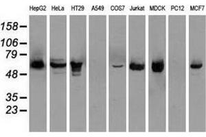 Western blot analysis of extracts (35 µg) from 9 different cell lines by using anti-CHEK2 monoclonal antibody. (CHEK2 抗体)