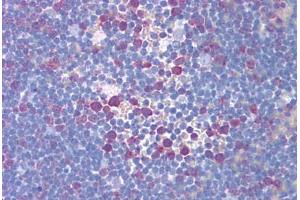 Human Thymus (formalin-fixed, paraffin-embedded) stained with TYMS antibody ABIN293172 at 5 ug/ml followed by biotinylated secondary antibody, alkaline phosphatase-streptavidin and chromogen. (TYMS 抗体)