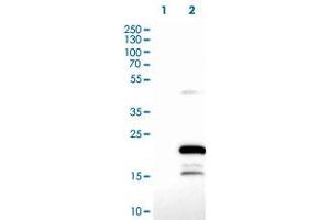 Western Blot (Cell lysate) analysis of (1) Negative control (vector only transfected HEK293T lysate), and (2) Over-expression lysate (Co-expressed with a C-terminal myc-DDK tag (~3. (ZCCHC13 抗体)