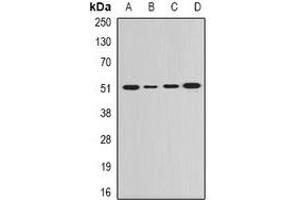 Western blot analysis of GDA expression in Hela (A), SKOV3 (B), mouse lung (C), rat brain (D) whole cell lysates. (GDA 抗体)