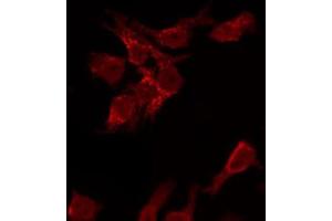 ABIN6267474 staining HeLa by IF/ICC. (AKT1 抗体  (pSer473))