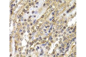 Immunohistochemistry of paraffin-embedded Rat kidney using NEDD9 Polyclonal Antibody at dilution of 1:200 (40x lens). (NEDD9 抗体)