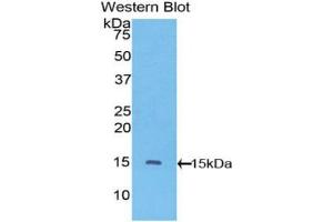 Western blot analysis of the recombinant protein. (VEGFC 抗体  (AA 108-223))