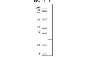 Western Blot showing cTnI antibody used against truncated cTnI recombinant protein. (TNNI3 抗体)
