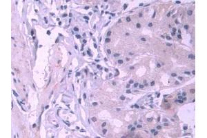 DAB staining on IHC-P; Samples: Human Stomach Tissue (PES1 抗体  (AA 1-415))
