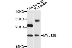 Western blot analysis of extract of mouse lung and rat brain cells, using MYL12B antibody. (MYL12B 抗体)