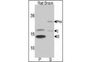 Western Blotting (WB) image for anti-Microtubule-Associated Protein 1 Light Chain 3 beta (MAP1LC3B) (AA 1-30), (N-Term) antibody (ABIN5555711)