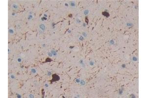 Detection of CR in Human Brain Tissue using Polyclonal Antibody to Calretinin (CR) (Calretinin 抗体  (AA 28-248))