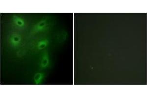 Immunofluorescence analysis of HeLa cells, using TRIM59 Antibody. (TRIM59 抗体  (AA 191-240))