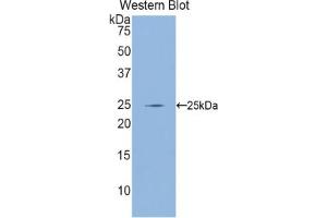 Western blot analysis of the recombinant protein. (GCLC 抗体  (AA 435-636))