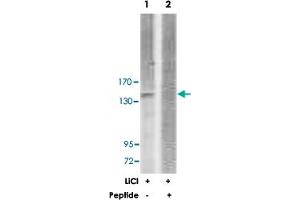 Western blot analysis of extracts from 293 cells, treated with LiCl (0. (ERBB3 抗体)