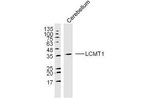 Mouse cerebellum lysates probed with LCMT1 Polyclonal Antibody, unconjugated  at 1:300 overnight at 4°C followed by a conjugated secondary antibody at 1:10000 for 90 minutes at 37°C. (LCMT1 抗体  (AA 45-150))