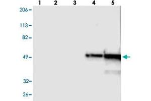 Western blot analysis of Lane 1: RT-4, Lane 2: U-251 MG, Lane 3: A-431, Lane 4: Liver, Lane 5: Tonsil with FGB polyclonal antibody . (Fibrinogen beta Chain 抗体)