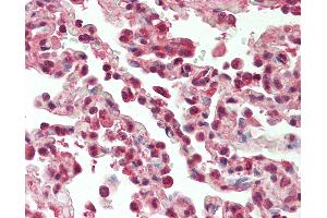 Anti-SF1 antibody IHC staining of human lung. (Splicing Factor 1 抗体  (AA 65-114))